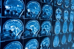 brain scan mri neurology xray