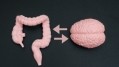 Review links gut-brain axis to sleep, metabolic syndrome